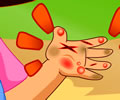 Curando os machucados das mãos de Dora